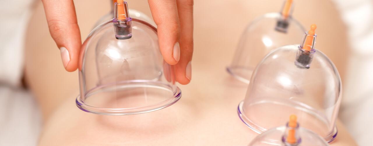 cupping